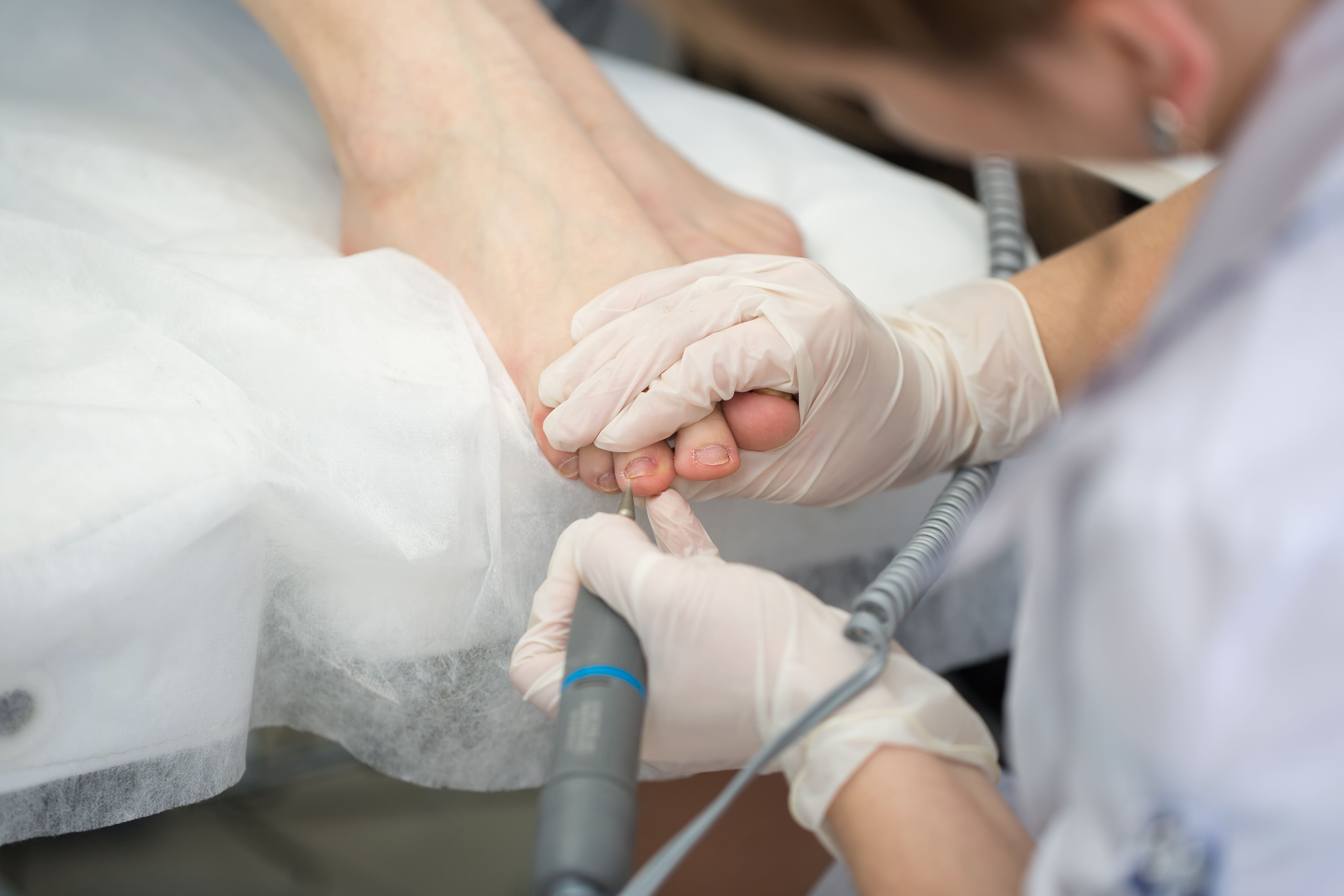 Pedicura médica profesional